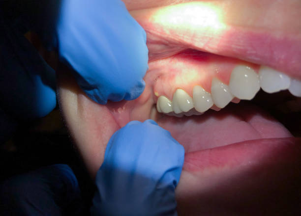 Best Emergency Treatment for Toothache in St Johns, MI