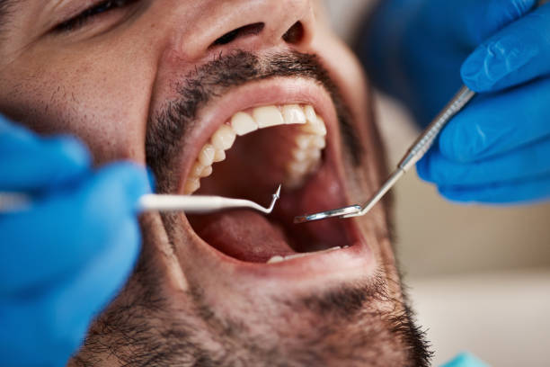 Best Emergency Dental Surgery in St Johns, MI